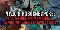 Спасатели и врачи спасли новосибирца, которому воткнули в голову садовые вилы - Precedent.TV