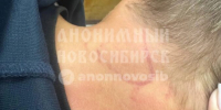 Подростковая банда терроризирует жителей Акатуйского жилмассива в Новосибирске - Precedent.TV