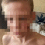 Брат избитого отцом 9-летнего мальчика рассказал главе Самары о насилии в семье - Самарская Газета