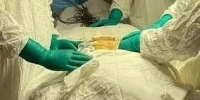 В Липецке врачи спасли пациентку с онкологией и тяжелым аутоиммунным недугом - МОЁ! Липецк