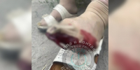 В Воронеже пенсионерка повредила ногу после падения в автобусе - ГТРК Воронеж