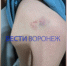 В Воронеже сбежавший от родителей инвалид ударил троих детей на улице - ГТРК Воронеж