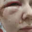 Жительница Назарово получила черепно-мозговую травму и сотрясение, упав в темноте в вырытую коммунальщиками траншею - ИА Запад24