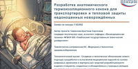 Ассистент кафедры «Биомедицинская техника» стала победителем всероссийского конкурса УМНИК - ТГТУ