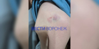 В Воронеже задержали ударившего трёх детей инвалида - ГТРК Воронеж