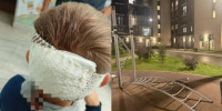 12 швов наложили ребенку, травмированному на детской площадке - Газета Навигатор