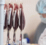 Хирурги НИИ Джанелидзе спасли девушку после тяжелого ДТП на мотоцикле - Комсомольская правда