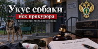 В Пинежском районе по иску прокурора взыскана компенсация морального вреда в пользу ребенка, которого укусила собака - Arh112.ru