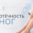 Отёчность ног может появляться как у здоровых людей, так и быть признаком заболеваний - Администрация Ейского района