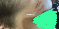 Пинали по голове: в Барнауле подростки напали на сверстника - Barneos22.ru