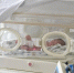 Беременную женщину с отслойкой плаценты и ребенка спасли в роддоме в Дмитрове - M24.Ru