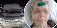 "Тащил ее без сознания за капюшон": пьяный кировчанин, сбивший женщину, отделался лишением прав - Город Киров