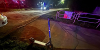 В Копейске подросток на электросамокате сбил пятилетнюю девочку - Агентство новостей Доступ