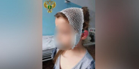 В Магнитогорске бездомная собака едва не оторвала ухо 6-летней девочке - M24.Ru