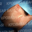 Фото: скриншот | В Приморье врачи удалили гигантскую опухоль с лица пациентки, сохранив ей мимику - PrimPress.Ru