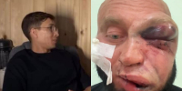 «Забили до комы»: юрист рассказал, что грозит нападавшим у бара «Крыша» в Новосибирске - Сиб.фм