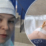 После удара током фасовщица перестала ходить и говорить - Город Киров