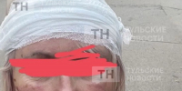 Пыталась оттащить, а на меня набросились: администратор рассказала о том, как получила травмы в ходе конфликта - ИА Тульские новости