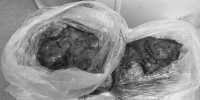 Редкую опухоль весом 10,4 кг удалили онкологи Татарстана у пациента с необычным строением почки - Республиканский онкодиспансер