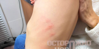 В детском саду шкаф упал и покалечил  пятерых малышей: родители давно жаловались на плохие условия - Gubdaily.Ru