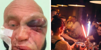 «Забивали до потери сознания»: в Новосибирске задержаны подозреваемые в жестоком избиении у бара «Крыша» - Сиб.фм