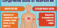Как самостоятельно отличить сердечную боль от невралгии? - Министерство здравоохранения