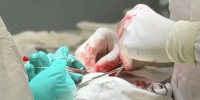 Воронежцу с множественными опухолями сделали сложную операцию во рту - Комсомольская Правда