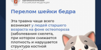 Что нужно знать о переломе шейки бедра, рассказали псковичам в Минздраве - Pln-Pskov.Ru