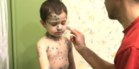 . - Лангепасская ГБ