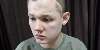 В лечении нуждается 17-летний Вадим Рудченко с опухолью головного мозга - Армавирский Собеседник