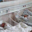 В Карелии в сентябре родилась одна двойня - StolicaOnego.Ru