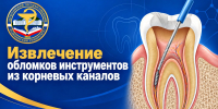 Ученые ДГМУ запатентовали устройство для извлечения обломков инструментов из корневых каналов - Медицинский Университет