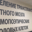 В тульском онкоцентре провели семь операций по трансплантации стволовых клеток - ИА Тульская служба новостей