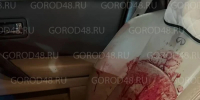 «Моего мужа сбили на мотоцикле, а потом пырнули ножом» - Gorod48.ru