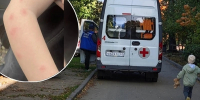 "Его искусали клопы!": мама обвинила больницу в атаке насекомых - Город Киров