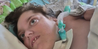 В Калининграде собирают деньги на медицинский аппарат для 16-летней девочки - Комсомольская правда
