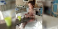 У 7-летней девочки отслоилась кожа после лечения в воронежской клинике - ГТРК Воронеж