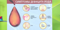 Как йододефицит влияет на иммунитет - Пильнинский муниципальный округ