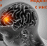 Неделя борьбы с инсультом - ТФОМС Пермского края