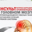 В Башкортостане стартовала Неделя борьбы с инсультом - Министерство здравоохранения РБ