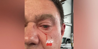 В Екатеринбурге на консультанта в автосервисе набросился клиент - КП Екатеринбург