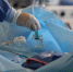 Челябинские врачи справились с редкой патологией сердца - Полит74