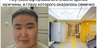 В глаз мужчины из Якутии попало семечко растения и пустило там корни - ТРК Татарстан-Новый век