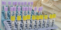 В Омской области циркулирует вирус COVID-19% - Вечерний Омск