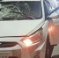 18-летний водитель иномарки насмерть сбил женщину в Слободском районе - Prochepetsk.ru