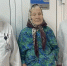 В Липецке хирурги спасли 85-летнюю пациентку с редкой аномалией - LipetskNews.Ru